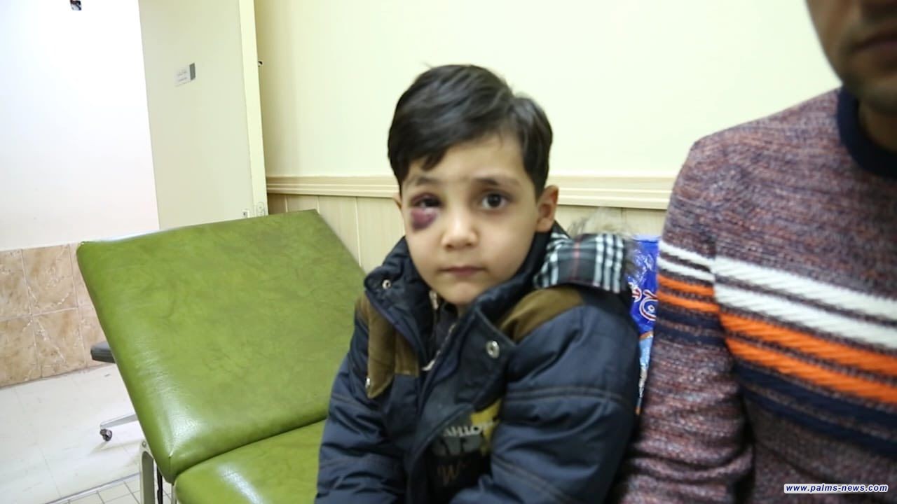 الألعاب النارية تُخلّف عشرات إصابات العيون في بغداد ليلة رأس السنة