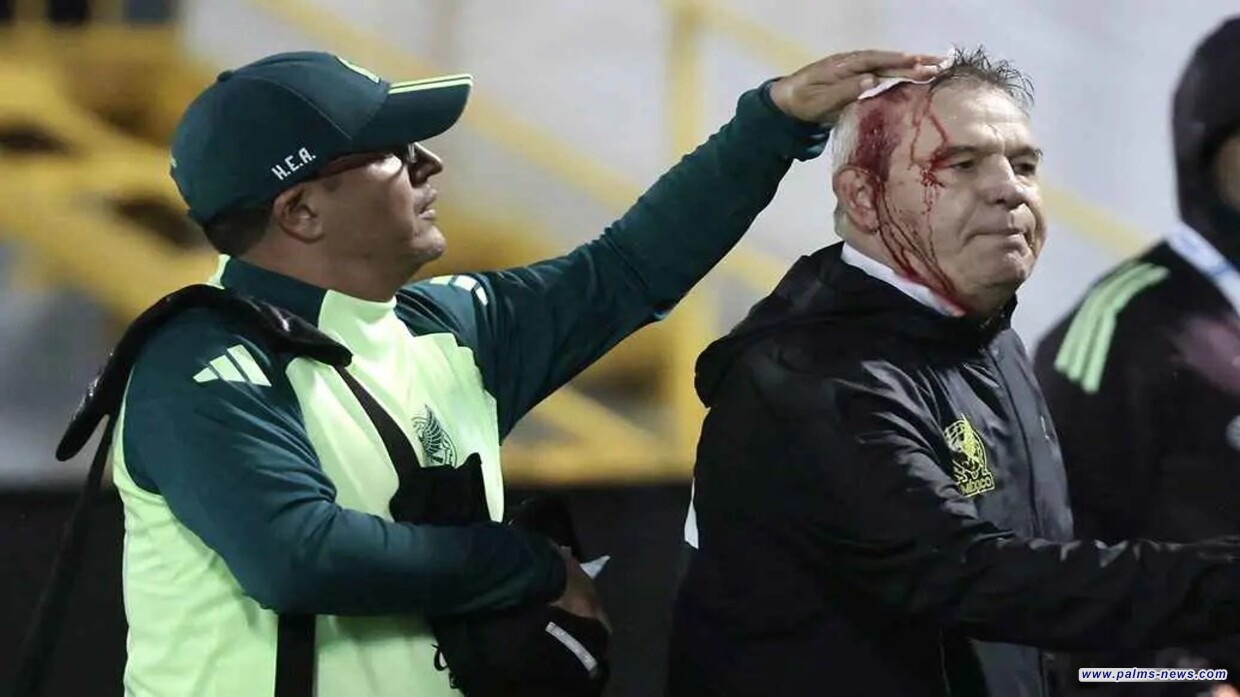 عقب الخسارة في هندوراس.. إصابة دامية لمدرب المكسيك