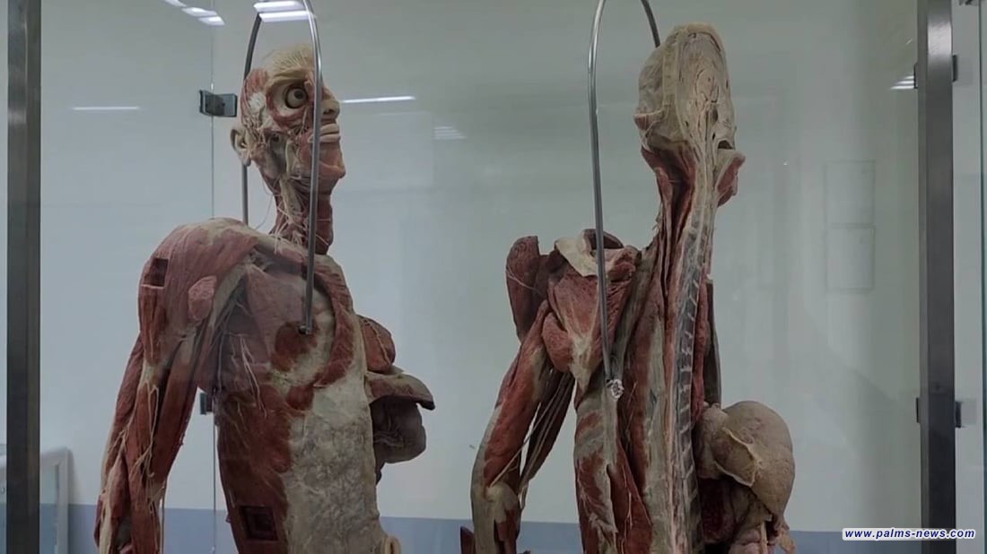 جثثٌ ألمانية تصمد 100 عام بدلاً من الهندية في جامعة واسط