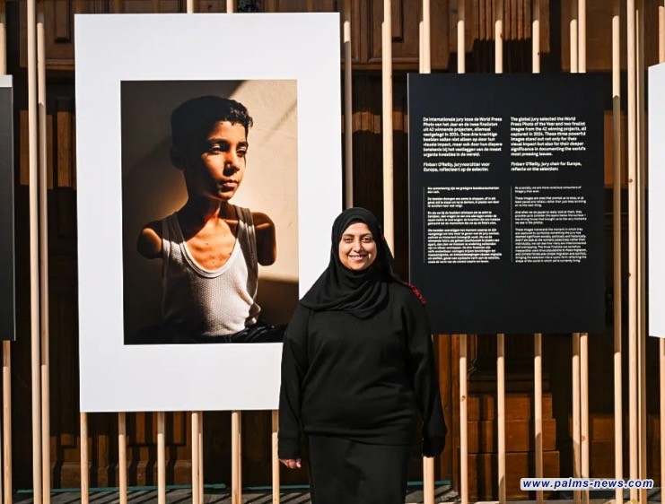 جائزة الصحافة العالمية لصورة فتى فلسطيني بترت يديه غارة إسرائيلية