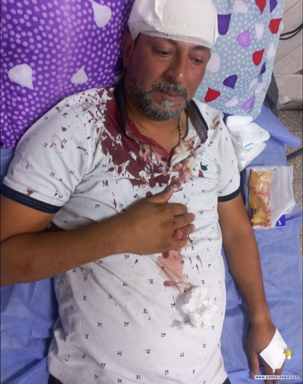 حالته خطرة.. أمانة بغداد تعلن تعرض أحد موظفيها لـ"اعتداء سافر"في منطقة بغداد الجديدة