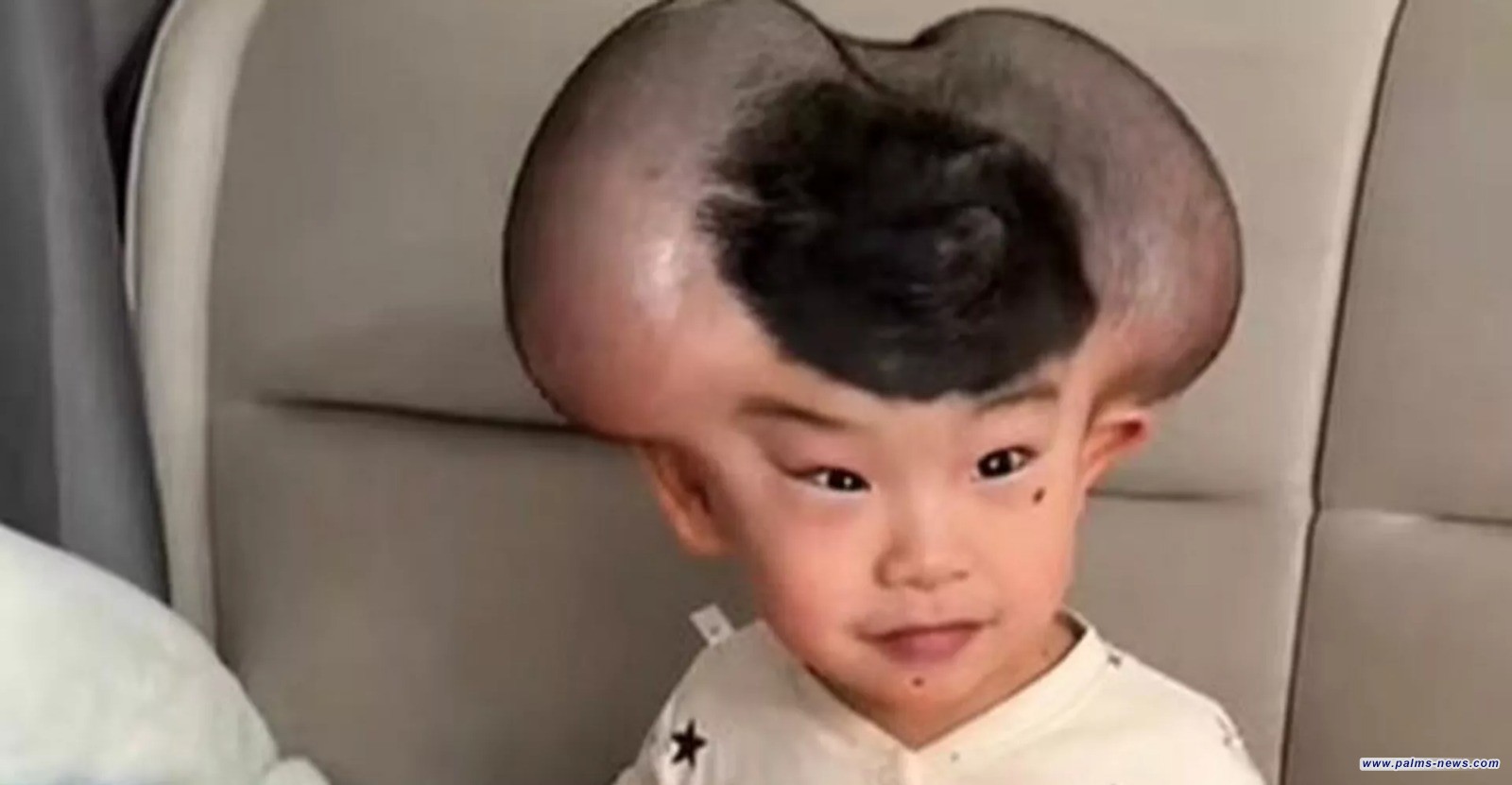 "ميكي ماوس".. شامات تعرض طفل صيني لـ"التنمر"