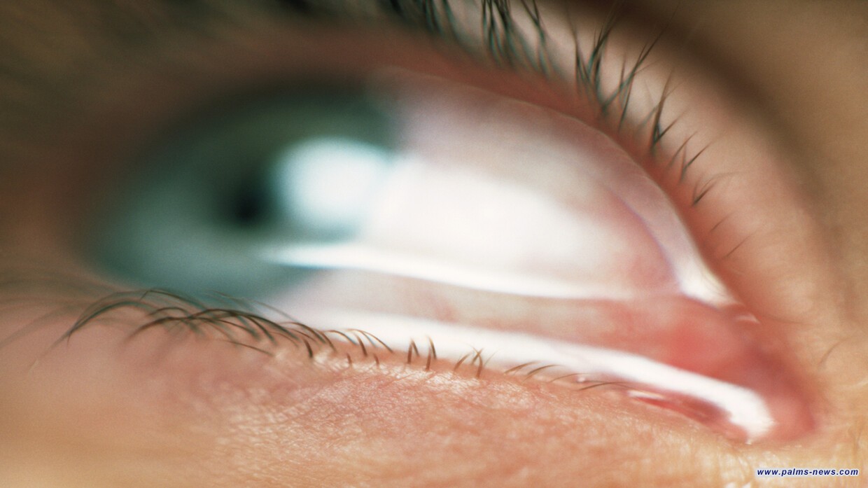 "طفل يذرف دما بدلا من الدموع".. حالة غامضة تحير الأطباء!