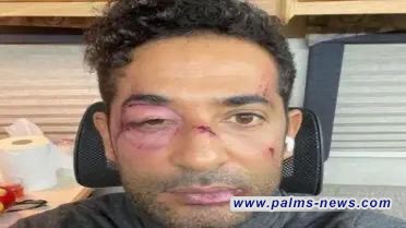 وجهه مهشم: من ضرب عمرو سعد؟