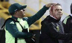 عقب الخسارة في هندوراس.. إصابة دامية لمدرب المكسيك