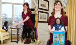 أطول وأقصر امرأتين في العالم يدخلان في موسوعة غينيس