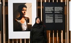 جائزة الصحافة العالمية لصورة فتى فلسطيني بترت يديه غارة إسرائيلية