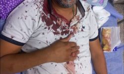 حالته خطرة.. أمانة بغداد تعلن تعرض أحد موظفيها لـ"اعتداء سافر"في منطقة بغداد الجديدة