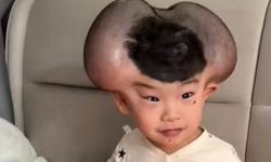 "ميكي ماوس".. شامات تعرض طفل صيني لـ"التنمر"