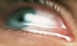 "طفل يذرف دما بدلا من الدموع".. حالة غامضة تحير الأطباء!