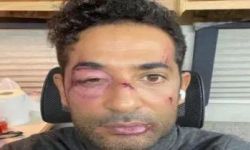 وجهه مهشم: من ضرب عمرو سعد؟